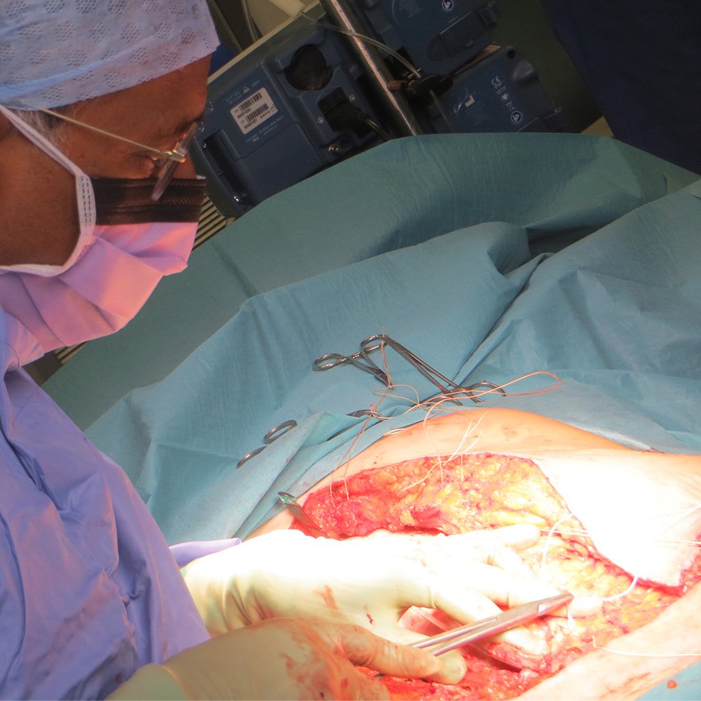 Case York_7_In Surgery